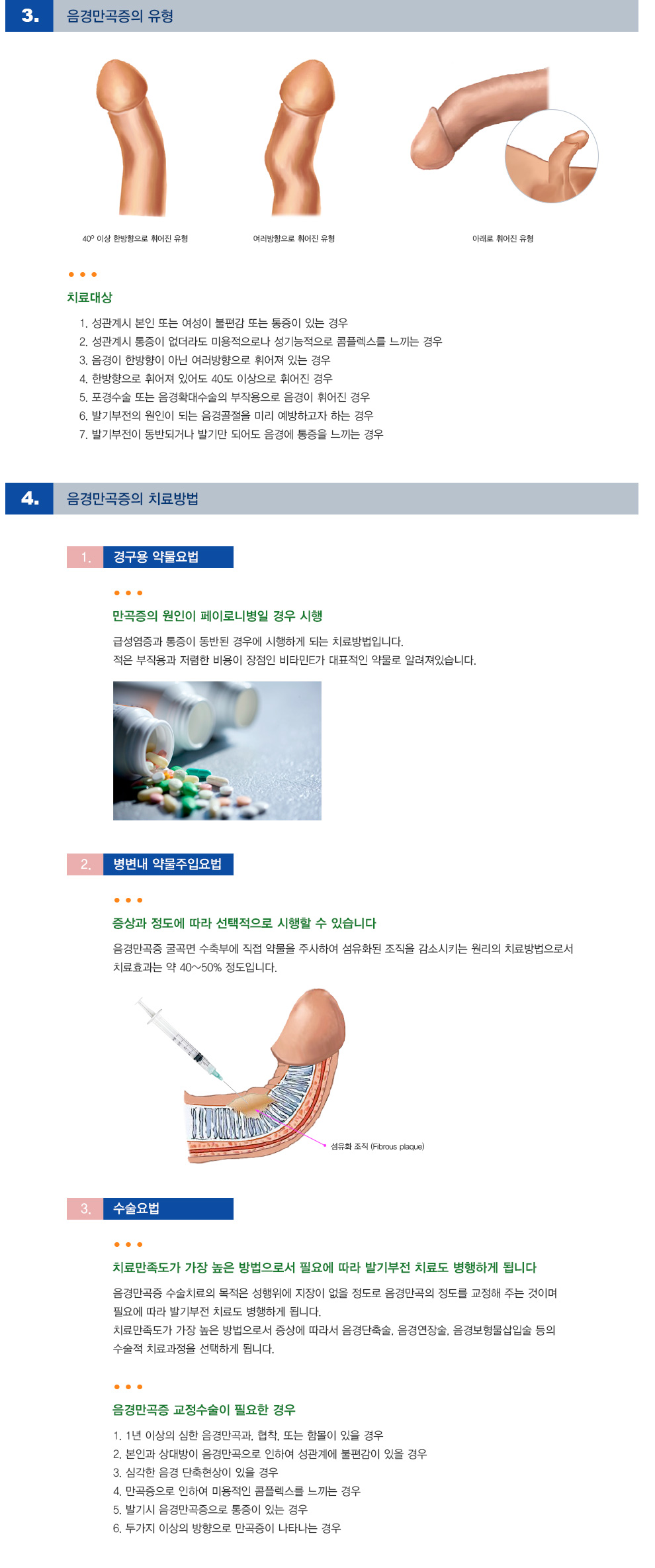 음경만곡증